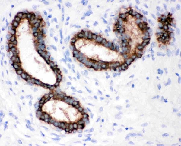 Immunohistochemistry analysis of Cytokeratin Peptide 18